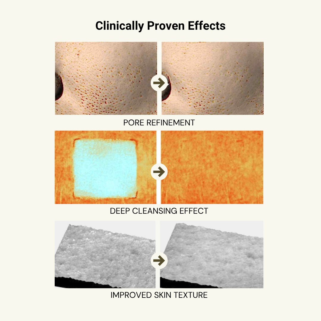 Relief Mud Pack To Foam Cleanser