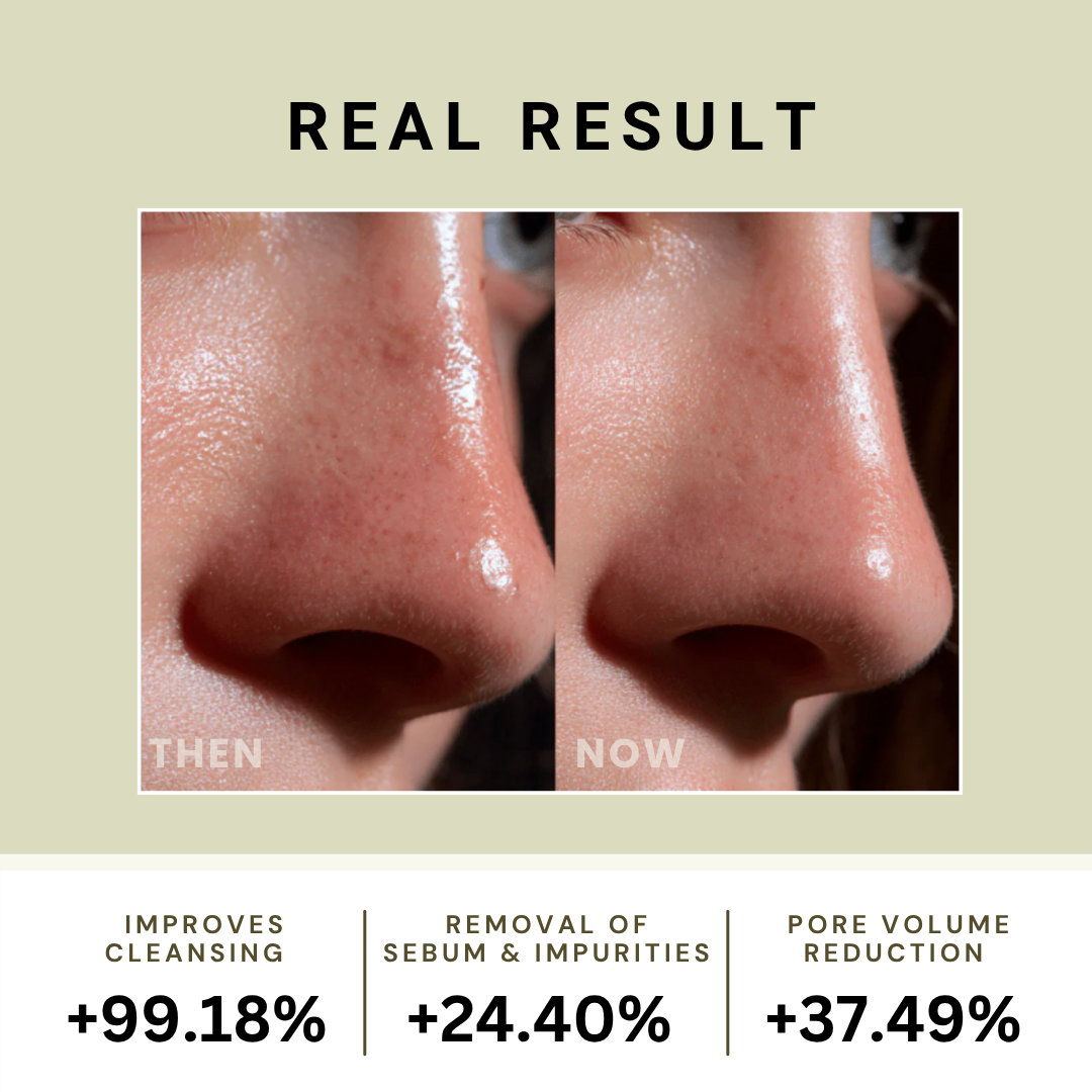 Relief Mud Mask & Cleanser Duo