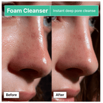 Before and after using BRMUD foam cleanser showing improved pore clarity